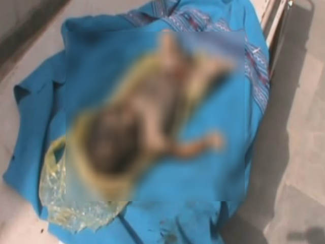 new born baby dead body