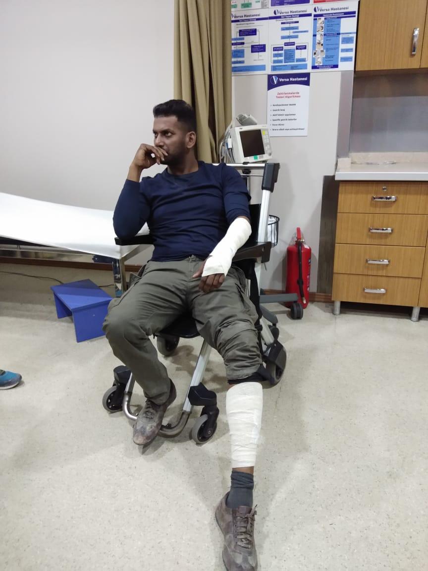 vishal got an injury in turkey shoot