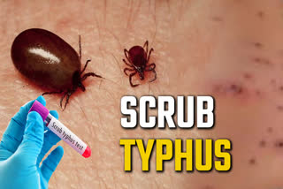 Scrub Typhus