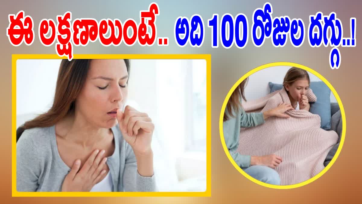 100 Day Cough