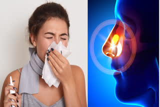 Cryo radio frequency procedure is very beneficial for people suffering from sinus problems, there will be no need for incision or surgery