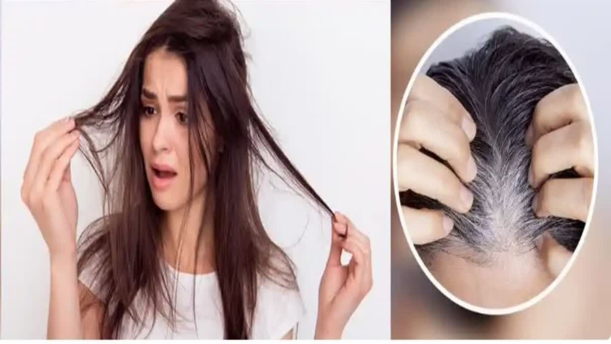 Ayurvedic Home Remedies For Dandruff Problem