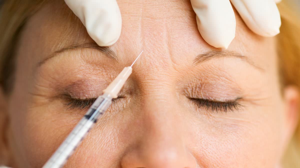 botox reduces aging effects on face and botox used to reduce facial wrinkles