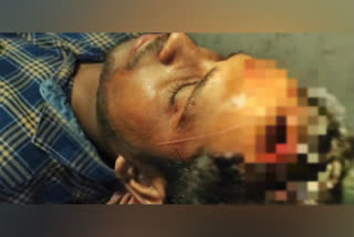 Lok Sabha Polls: ANI Stringer Bunty Mukherjee Severely Injured in TMC-BJP Clashes in West Bengal