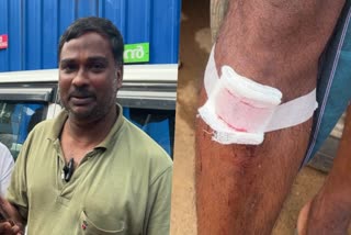 wild boar  wild boar attack  farmer  idukki  wild pig  കാട്ടുപന്നി  കാട്ടുപന്നിയുടെ ആക്രമണം  കര്‍ഷകന്‍  ബിനോയി  ഇടുക്കി  പുലിക്കുട്ടി