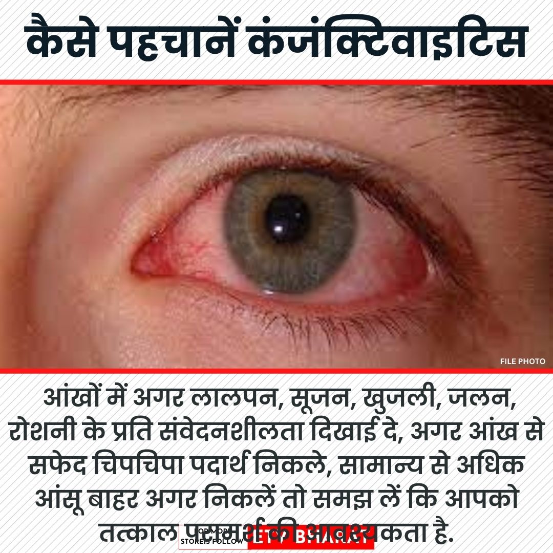 Conjunctivitis को कैसे पहचानें