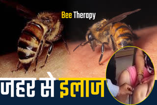 Being treated with Bee Venom therapy