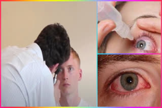eye infection cases