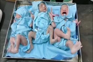 Woman gives Birth to Triplets