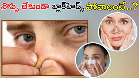 Natural Home Remedies For Blackheads