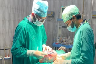 Eकानपुर देहात में चिकित्सकों ने जटिल ऑपरेशन कर बड़ा ट्यूमर निकाला.
