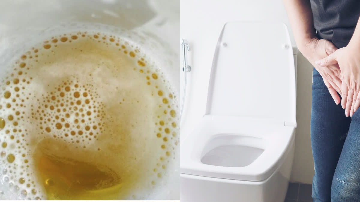 What is foamy urine and what is its cause