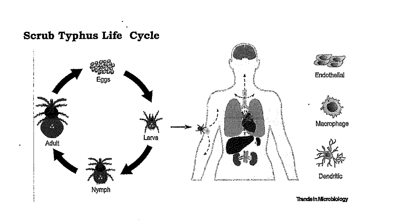 SCRUB TYPHUS  SCRUB TYPHUS SYMPTOMS  CRUB TYPHUS OUTBREAK  Rapidly Spreading Scrub Typhus