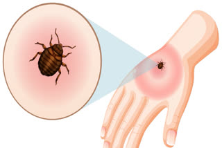 Scrub Typhus spreads through the bites of infected chiggers