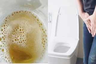 What is foamy urine and what is its cause