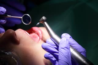 TEETH ROOT CANAL