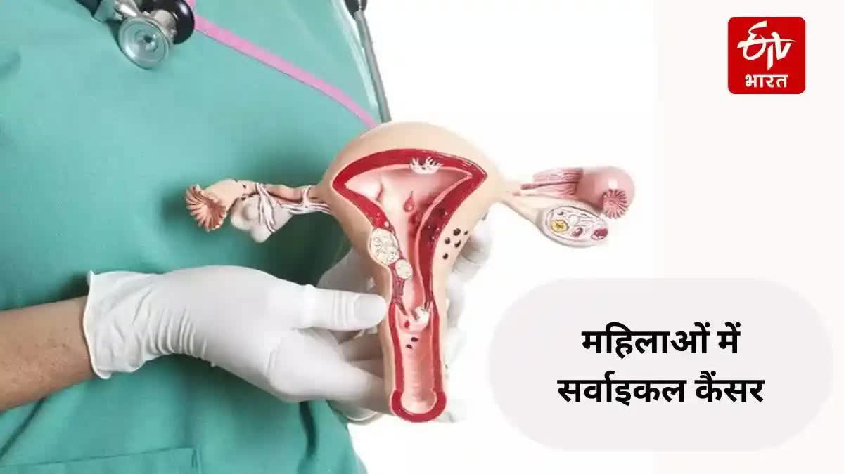 What is Cervical Cancer