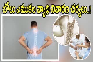 How to Prevent Osteoporosis