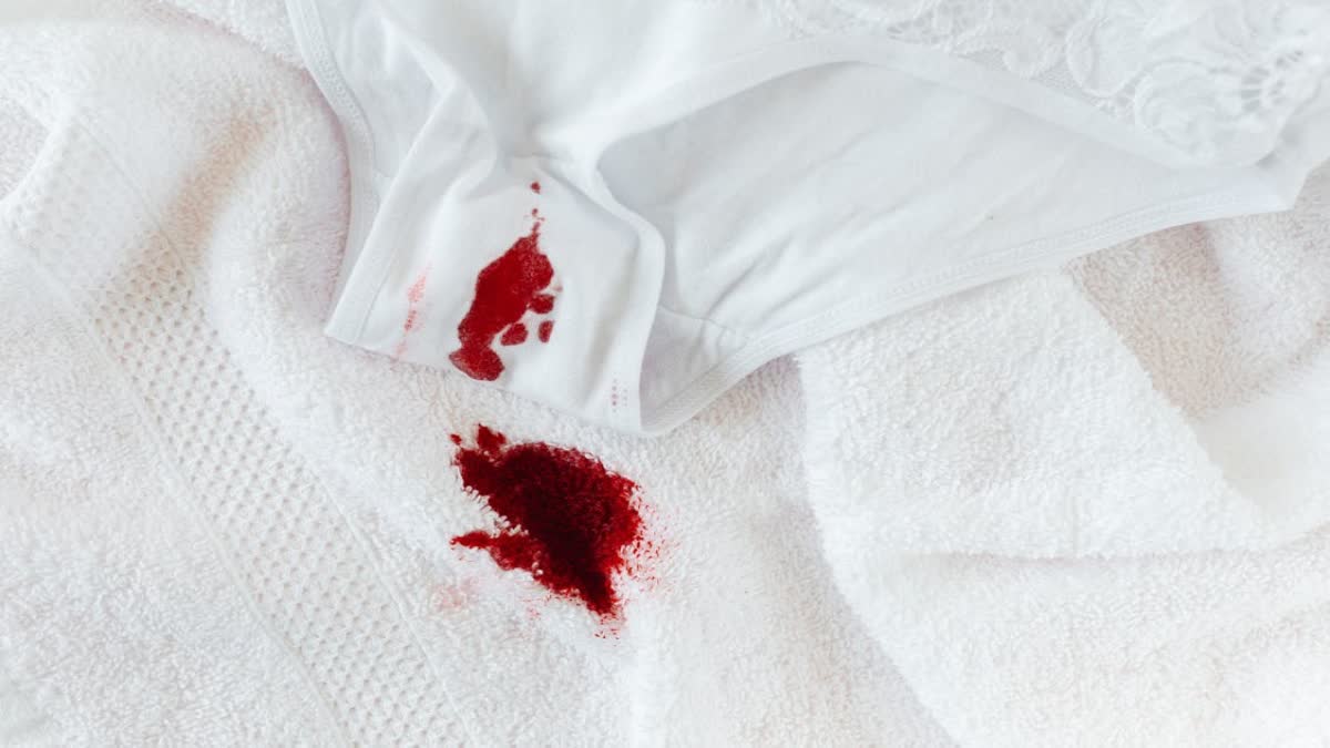 TOW TO REMOVE PERIOD STAIN QUICKLY  SIMPLE WAYS TO REMOVE PERIOD STAIN  EASY HACKS TO REMOVE PERIOD STAINS  TIPS FOR PERIOD STAINS REMOVAL