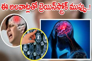 Brain Stroke Causes