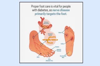 Foot Health  For Diabetes Patients