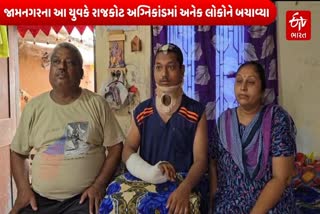 જીવ બચાવવા અંતે બીજા માળેથી કૂદકો માર્યો