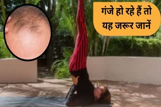 yoga tips to prevent hair fall detail in hindi
