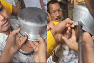 UP Child head stuck in Bowl