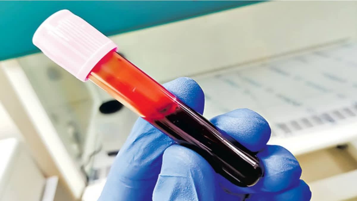 can-cancer-and-alzheimer-detect-from-blood-test-here-is-some-innovative-way