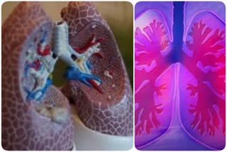 Lungs Cancer in Kashmir