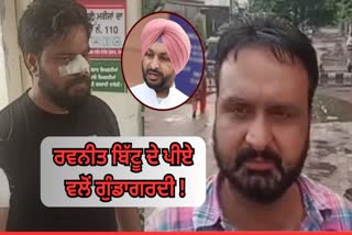 Allegation of Beating To Transporters On  PA of Ravneet Bittu