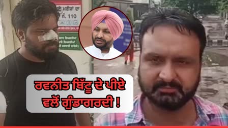 Allegation of Beating To Transporters On  PA of Ravneet Bittu