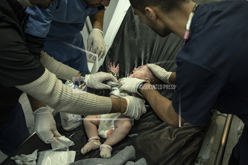 A Palestinian baby wounded in Israeli bombardment of the Gaza Strip is treated in a hospital in Khan Younis