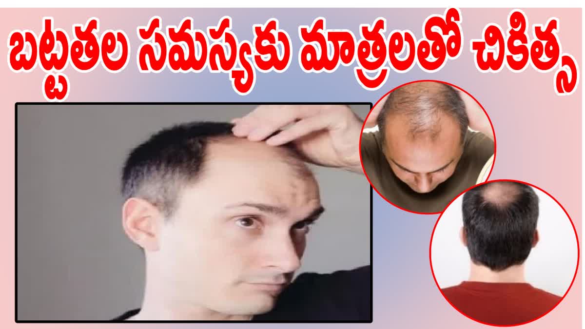 TIPS TO PREVENT MALE BALDNESS