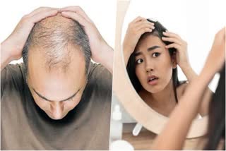 best_medicine_for_baldness