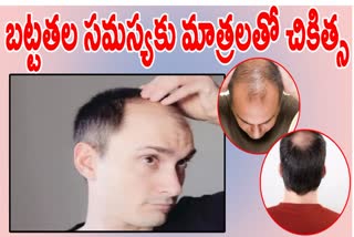 TIPS TO PREVENT MALE BALDNESS