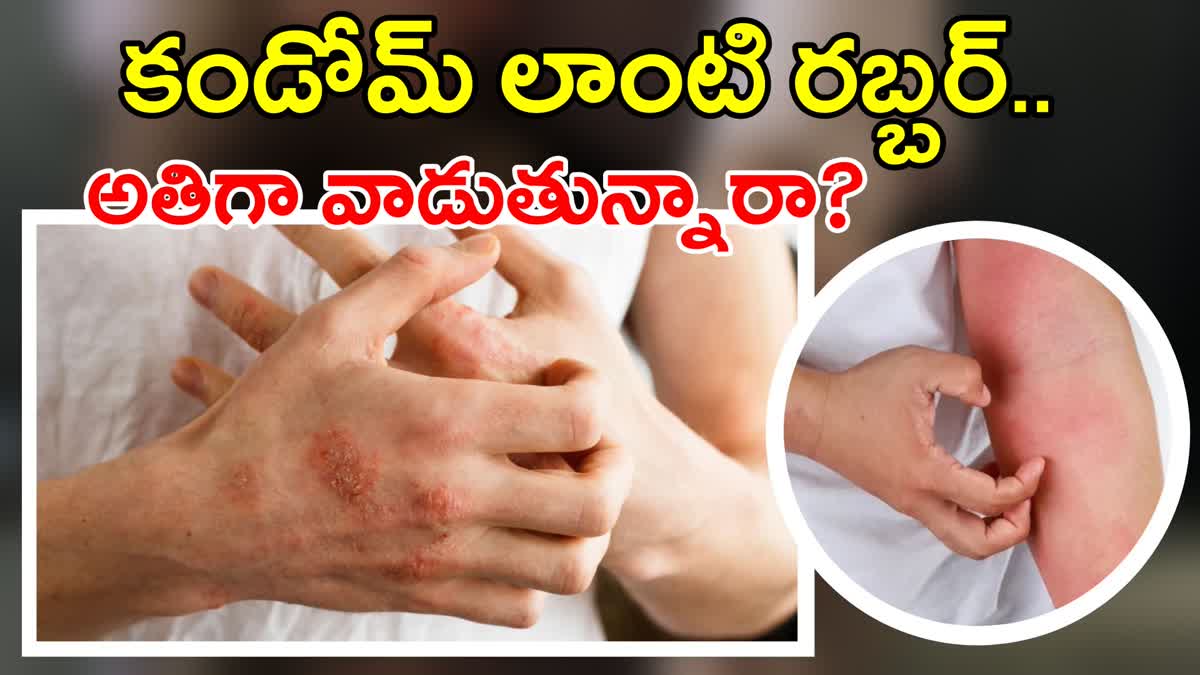 కండోమ్స్ లాంటి రబ్బరు వస్తువులు వాడుతున్నారా? - ఆ సమస్య రావడం పక్కా!