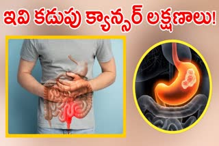 Gastric Cancer Symptoms