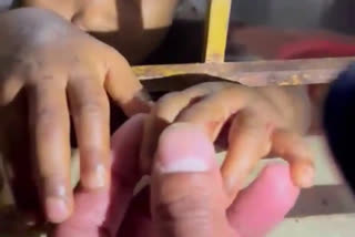 Mother assault  Boy rescued  അമ്മയുടെ ക്രൂര പീഡനം  3 വയസുകാരന് പീഡനം  അമ്മ