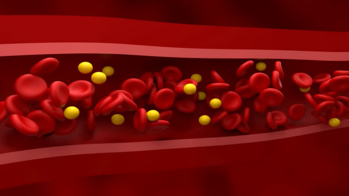 If there is severe pain in these 5 parts of the body, then understand that cholesterol has increased