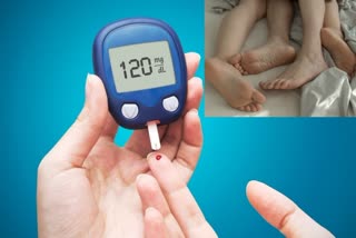 HOW DIABETES AFFECTS SEX DRIVE  SEX AND DIABETES  DIABETES REDUCE YOUR SEXUAL DESIRE  Diabetes