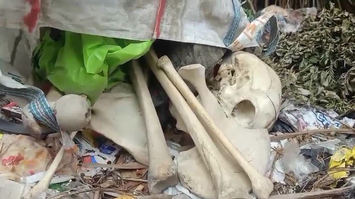 Skeleton recovered