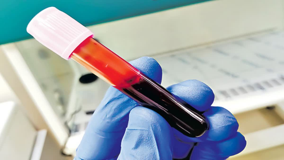 Blood Test News