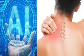 AI TO IDENTIFY OSTEOPOROSIS THREAT  TULANE UNIVERSITY SCIENTISTS  ഓസ്റ്റിയോപൊറോസിസ് കണ്ടെത്താന്‍ എഐ  OSTEOPOROSIS