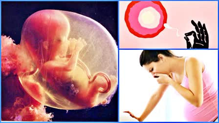 myths about Invitro fertilization pregnancy procedure