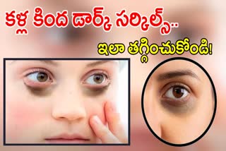 Dark Circles Causes and Treatment