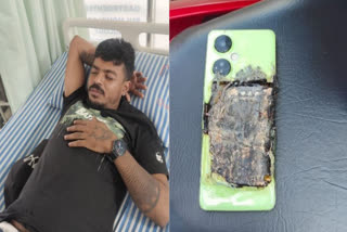 mobile phone Explosion  youthinjured  യുവാവിന് പരിക്ക്  മൊബൈല്‍ പൊട്ടിത്തെറി