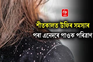 These Home Remedies helps you To Cure Dandruff Naturally