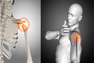 World Cancer Day 2025 Cancer also occurs in bones, know the causes and symptoms of bone cancer