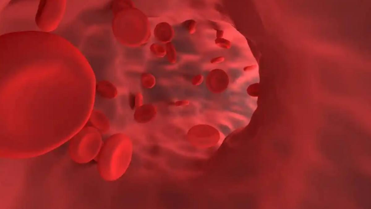 fatal blood disorder aplastic anaemia is significantly high in India